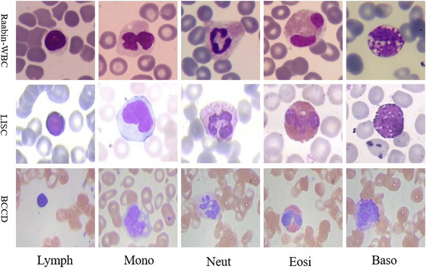 Some samples of the WBCs in Raabin-WBC, LISC, and BCCD datasets; Source